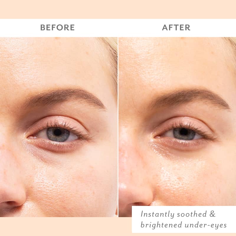Patchology Skin Remedy Soothing Eye Gels - Single